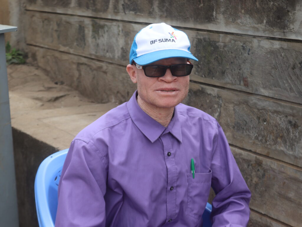 Wycliffe Watende, who lives with albinism