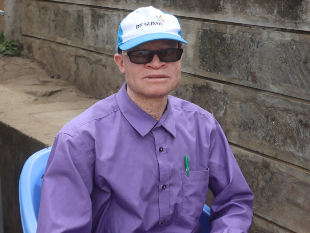 Wycliffe Watende, who lives with albinism